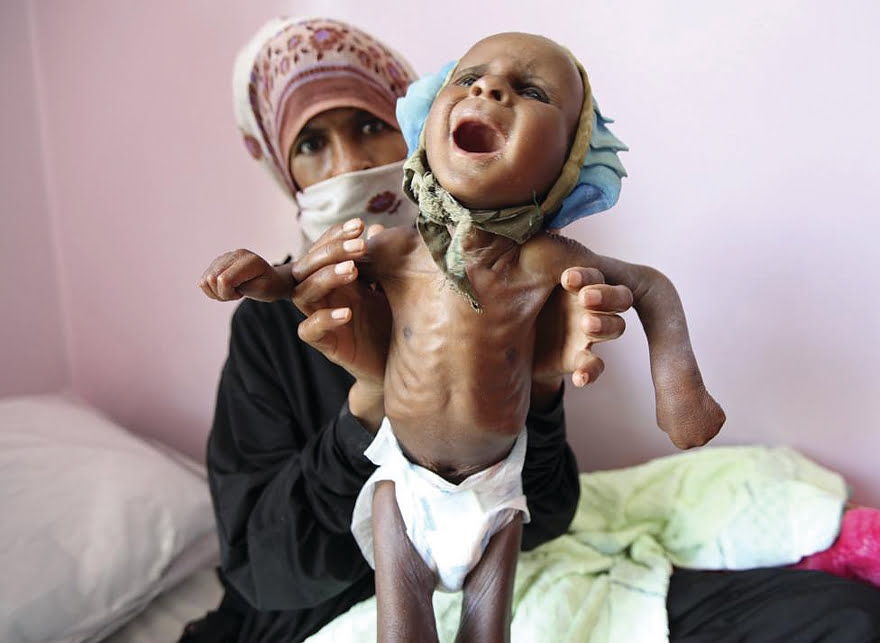Υεμένη: Ένας αόρατος πόλεμος