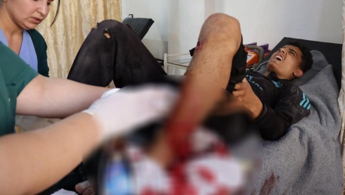 Σοβαρός τραυματισμός εφήβου στο Zirgan κατόπιν τουρκικής επίθεσης