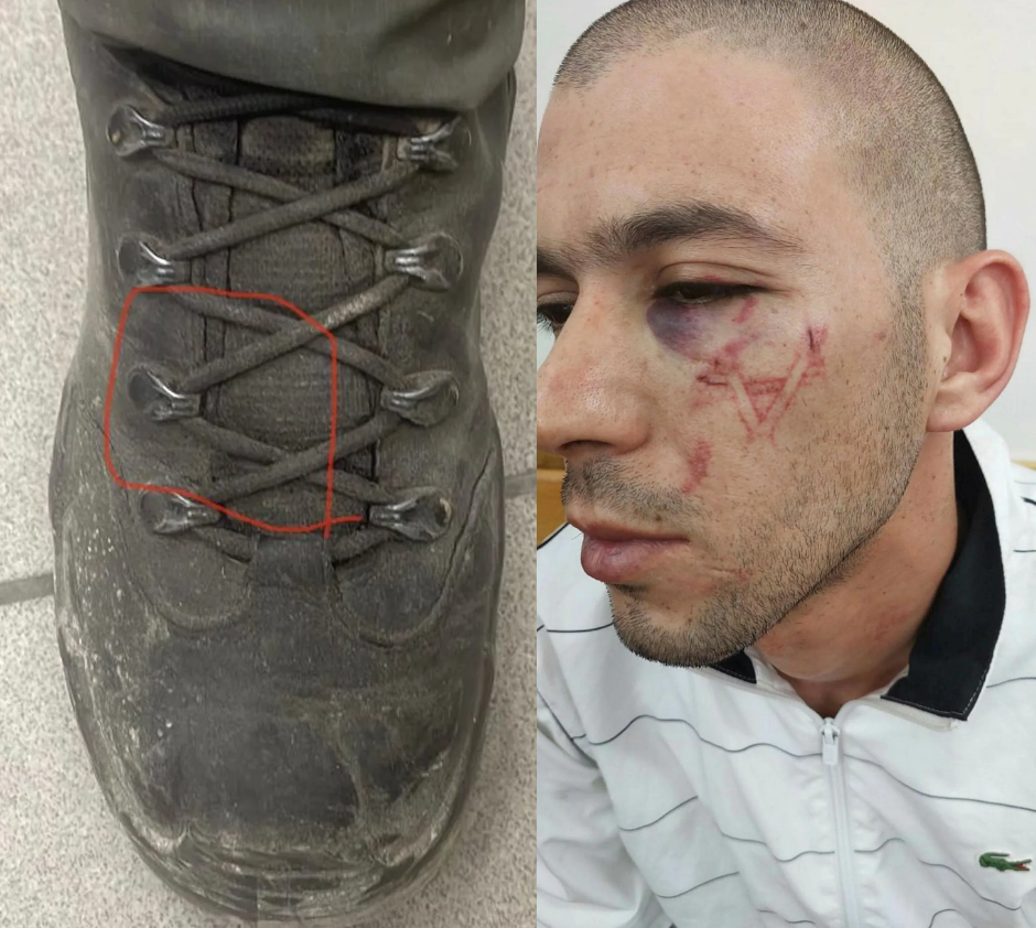 Η αστυνομία του Ισραήλ αρνείται ότι έχει χαράξει το αστέρι του Δαυΐδ στο πρόσωπο Παλαιστινίου κρατουμένου, ισχυριζόμενη ότι το χάραγμα έγινε από το μποτάκι αστυνομικού