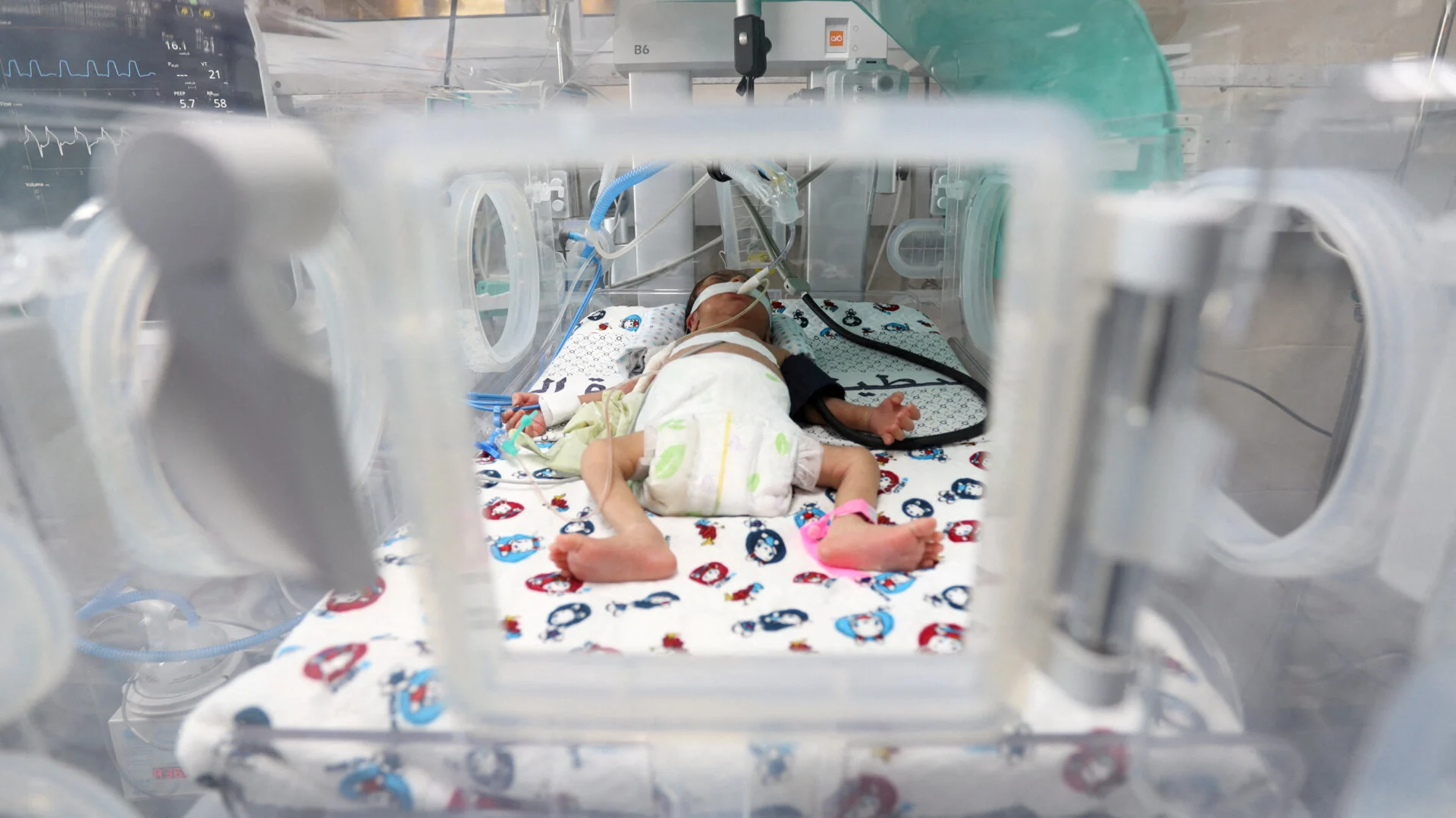 Γάζα: Δεν υπάρχουν πλέον μωρά «φυσιολογικού μεγέθους»